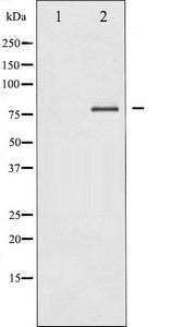 Western blot analysis of PKC delta expression in MCF7 whole cell lysates,The lane on the left is treated with the antigen-specific peptide.