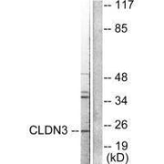 Western blot analysis of extracts from HuvEc cells, using Claudin 3 antibody.