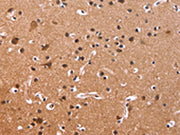 The image on the left is immunohistochemistry of paraffin-embedded Human brain tissue using CSB-PA193371(CSNK1D Antibody) at dilution 1/50, on the right is treated with fusion protein. (Original magnification: ×200)