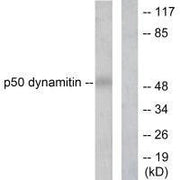 Western blot analysis of extracts from A549 cells, using p50 dynamitin antibody.