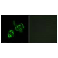 Immunofluorescence analysis of A549 cells, using SLC27A4 antibody.