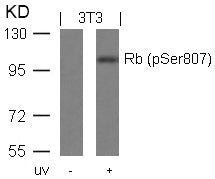 Western blot analysis of extracts from 3T3 cells untreated or treated with UV using Rb(Phospho-Ser807) Antibody.