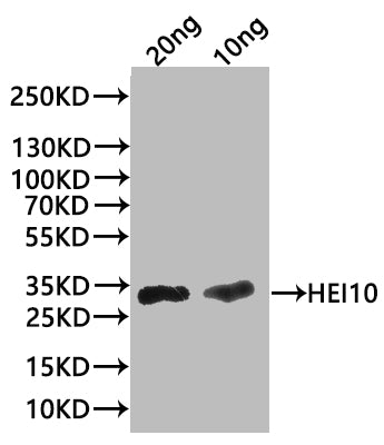 Western Blot Positive WB detected in: recombinant protein All lanes:HEI10 Antibody at 1:1000 Secondary Goat polyclonal to rabbit IgG at 1/20000 dilution Predicted band size: 27.9 kDa Observed band size: 31 kDa