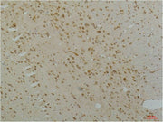 Immunohistochemical analysis of paraffin-embedded Rat Brain Tissue using Cav1.2Rabbit pAb diluted at 1:200.