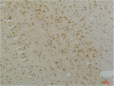 Immunohistochemical analysis of paraffin-embedded Rat Brain Tissue using Cav1.2Rabbit pAb diluted at 1:200.
