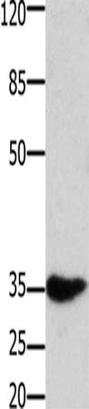 Gel: 10%SDS-PAGE, Lysate: 40 ug, Lane: Mouse muscle tissue, Primary antibody: CSB-PA195151(HOXA11 Antibody) at dilution 1/350, Secondary antibody: Goat anti rabbit IgG at 1/8000 dilution, Exposure time: 1 minute