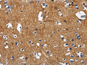 The image on the left is immunohistochemistry of paraffin-embedded Human brain tissue using CSB-PA195475(CADM3 Antibody) at dilution 1/40, on the right is treated with fusion protein. (Original magnification: ×200)