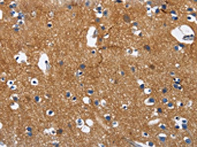 The image on the left is immunohistochemistry of paraffin-embedded Human brain tissue using CSB-PA195475(CADM3 Antibody) at dilution 1/40, on the right is treated with fusion protein. (Original magnification: ×200)