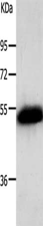 Gel: 10%SDS-PAGE, Lysate: 40 ug, Lane: Human liver cancer tissue, Primary antibody: CSB-PA195617(ADRB2 Antibody) at dilution 1/300, Secondary antibody: Goat anti rabbit IgG at 1/8000 dilution, Exposure time: 30 seconds