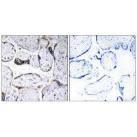 Immunohistochemistry analysis of paraffin-embedded human placenta tissue using ELOVL3 antibody.
