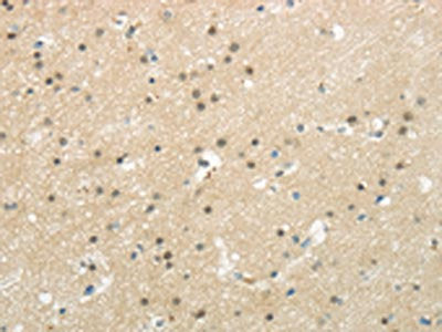 The image on the left is immunohistochemistry of paraffin-embedded Human brain tissue using CSB-PA196402(BAZ1B Antibody) at dilution 1/20, on the right is treated with synthetic peptide. (Original magnification: ×200)