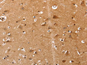 The image on the left is immunohistochemistry of paraffin-embedded Human brain tissue using CSB-PA196434(VIMP Antibody) at dilution 1/20, on the right is treated with synthetic peptide. (Original magnification: ×200)