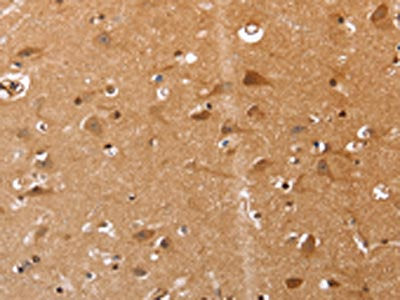 The image on the left is immunohistochemistry of paraffin-embedded Human brain tissue using CSB-PA196434(VIMP Antibody) at dilution 1/20, on the right is treated with synthetic peptide. (Original magnification: ×200)