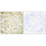 Immunohistochemistry analysis of paraffin-embedded human heart tissue using Collagen XIV α1 antibody.