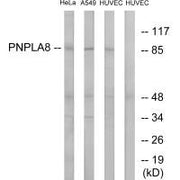 Western blot analysis of extracts from HeLa cells, A549 cells and HUVEC cells, using PNPLA8 antibody.
