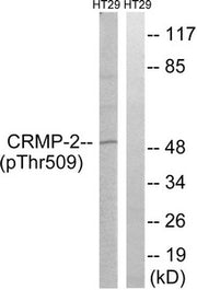 Western blot analysis of extracts from HT-29 cells treated with heat shock using CRMP-2 (Phospho-Thr509) Antibody.The lane on the right is treated with the antigen-specific peptide.