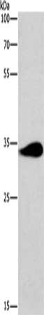 Gel: 8%SDS-PAGE, Lysate: 40 ug, Lane: Mouse brain tissue, Primary antibody: CSB-PA197029(TNIP3 Antibody) at dilution 1/200, Secondary antibody: Goat anti rabbit IgG at 1/8000 dilution, Exposure time: 1 minute
