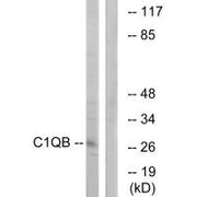 Western blot analysis of extracts from Jurkat cells, using C1QB antibody.