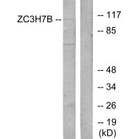 Western blot analysis of extracts from 293 cells, using ZC3H7B antibody.