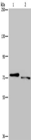 Gel: 8%SDS-PAGE, Lysate: 40 ug, Lane 1-2: Mouse heart tissue, Mouse skeletal muscle tissue, Primary antibody: CSB-PA197311(NLRP10 Antibody) at dilution 1/300, Secondary antibody: Goat anti rabbit IgG at 1/8000 dilution, Exposure time: 1 minutes