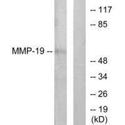 Western blot analysis of extracts from HuvEc cells, using MMP-19 antibody.