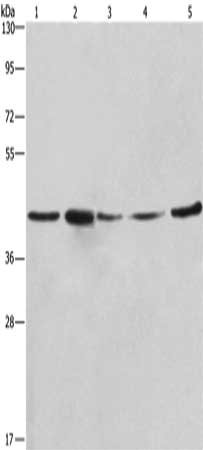 Gel: 10%SDS-PAGE, Lysate: 40 ug, Lane 1-5: A549 cells, NIH/3T3 cells, 293T cells, human hepatocellular carcinoma tissue, hela cells, Primary antibody: CSB-PA197545(RPSA Antibody) at dilution 1/425, Secondary antibody: Goat anti rabbit IgG at 1/800...