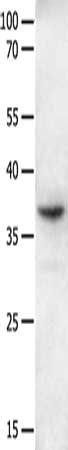 Gel: 10%SDS-PAGE, Lysate: 40 ug, Lane: Mouse intestinum tenue tissue, Primary antibody: CSB-PA197658(GPR6 Antibody) at dilution 1/250, Secondary antibody: Goat anti rabbit IgG at 1/8000 dilution, Exposure time: 2 minutes