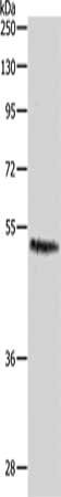 Gel: 8%SDS-PAGE, Lysate: 40 ug, Lane: Hela cells, Primary antibody: CSB-PA198247(CASP2 Antibody) at dilution 1/1000, Secondary antibody: Goat anti rabbit IgG at 1/8000 dilution, Exposure time: 1 minute