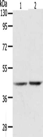 Gel: 10%SDS-PAGE, Lysate: 40 ug, Lane 1-2: Hela cells, human fetal liver tissue, Primary antibody: CSB-PA198331(AGXT Antibody) at dilution 1/400, Secondary antibody: Goat anti rabbit IgG at 1/8000 dilution, Exposure time: 2 minutes