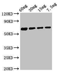 Western Blot Positive WB detected in Recombinant protein All lanes: Major allergen Bla g 1.0101 antibody at 2.8µg/ml Secondary Goat polyclonal to rabbit IgG at 1/50000 dilution Predicted band size: 62 kDa Observed band size: 62 kDa