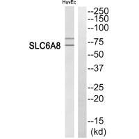 Western blot analysis of extracts from HuvEc cells, using SLC6A8 antibody.
