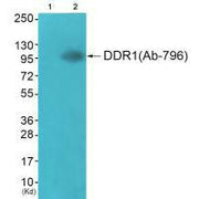 Western blot analysis of extracts from JK cells (Lane 2), using DDR1 (Ab-796) antiobdy. The lane on the left is treated with synthesized peptide.