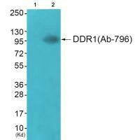 Western blot analysis of extracts from JK cells (Lane 2), using DDR1 (Ab-796) antiobdy. The lane on the left is treated with synthesized peptide.