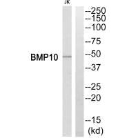 Western blot analysis of extracts from Jurkat cells, using BMP10 antibody.