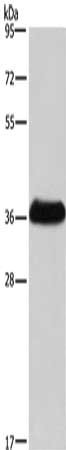 Gel: 8%SDS-PAGE, Lysate: 40 ug, Lane: Mouse skeletal muscle tissue, Primary antibody: CSB-PA199443(IFNGR2 Antibody) at dilution 1/400, Secondary antibody: Goat anti rabbit IgG at 1/8000 dilution, Exposure time: 40 seconds