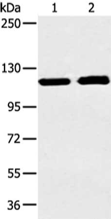 Gel: 6%SDS-PAGE, Lysate: 40 ug, Lane 1-2: Human mucinous type of soft tissue sarcoma and human fetal liver tissue, Primary antibody: CSB-PA199893(TERT Antibody) at dilution 1/250 dilution, Secondary antibody: Goat anti rabbit IgG at 1/8000 dilutio...