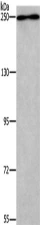 Gel: 6%SDS-PAGE, Lysate: 40 ug, Lane: Hela cells, Primary antibody: CSB-PA200191(WNK3 Antibody) at dilution 1/200, Secondary antibody: Goat anti rabbit IgG at 1/8000 dilution, Exposure time: 10 minutes