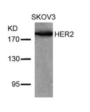 Western blot analysis of extracts from SKOV3 cells using HER2(Ab-877) Antibody.