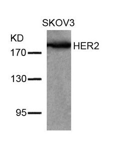 Western blot analysis of extracts from SKOV3 cells using HER2(Ab-877) Antibody.