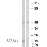 Western blot analysis of extracts from HepG2 cells, using SF3B14 antibody.