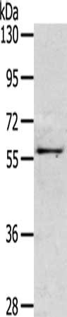 Gel: 6%SDS-PAGE, Lysate: 40 ug, Lane: Mouse intestines tissue, Primary antibody: CSB-PA201620(OLFM3 Antibody) at dilution 1/200, Secondary antibody: Goat anti rabbit IgG at 1/8000 dilution, Exposure time: 2 minutes