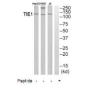 Western blot analysis of extracts from HepG2 cells, K562 cells and Jurkat cells, using TIE1 antibody.