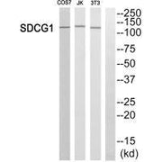 Western blot analysis of extracts from HUVEC cells, using SDCG1 antibody.