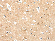 The image on the left is immunohistochemistry of paraffin-embedded Human brain tissue using CSB-PA202764(TIGAR Antibody) at dilution 1/20, on the right is treated with synthetic peptide. (Original magnification: ×200)