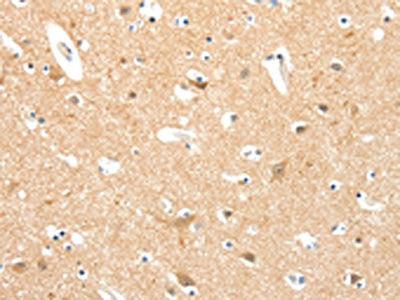 The image on the left is immunohistochemistry of paraffin-embedded Human brain tissue using CSB-PA202764(TIGAR Antibody) at dilution 1/20, on the right is treated with synthetic peptide. (Original magnification: ×200)