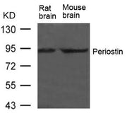 Western blot analysis of extract from Rat brain and Mouse brain Tissue using Periostin Antibody