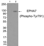 Western blot analysis of extracts from JK cells (Lane 2), using EPHA7 (Phospho-Tyr791) Antibody. The lane on the left is treated with antigen-specific peptide.