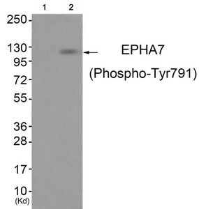 Western blot analysis of extracts from JK cells (Lane 2), using EPHA7 (Phospho-Tyr791) Antibody. The lane on the left is treated with antigen-specific peptide.