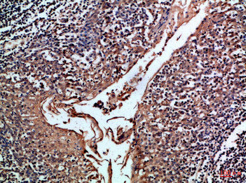 Immunohistochemical analysis of paraffin-embedded Human-tonsil, antibody was diluted at 1:100