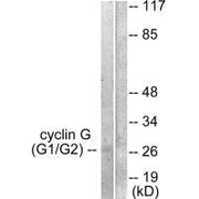 Western blot analysis of extracts from Jurkat cells, using Cyclin G antibody.